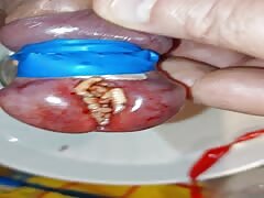 Pain cbt insertion bdsm pervers futter für maggots